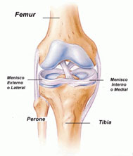 lesionmeniscos