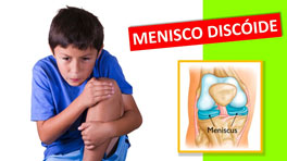 meniscodiscoide_clinicarehabilitacion02